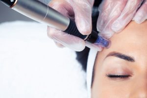 Woman receiving Microderm abrasion for skin care